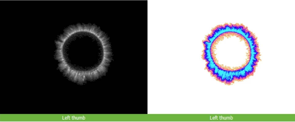 A Bio-Well fingertip scan, shown as a black and white image and a colour version, labelled Left thumb